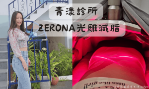 台中南屯醫美診所推薦_青漾診所_醫美紀錄_ZERONA光雕減脂_心得_前後對比照