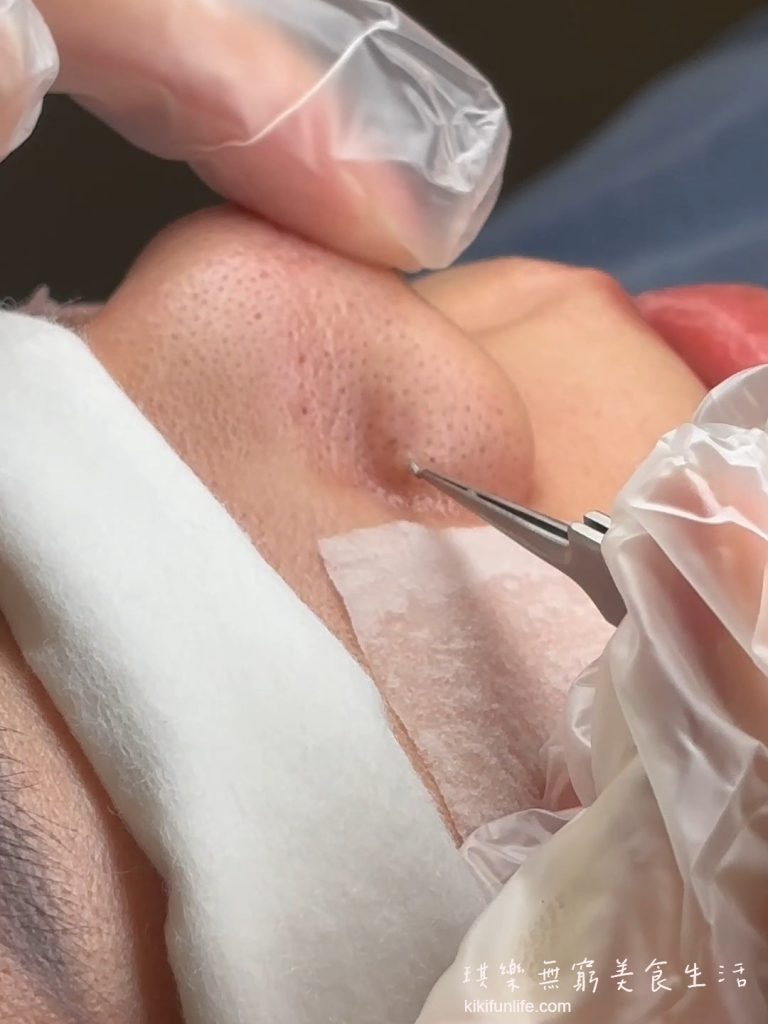 Chin Charm沁魅美學_台中做臉推薦_台中平價做臉_手工清粉刺_台中西屯美容院推薦_皮膚保養